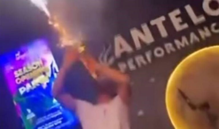 Gösteri için klarnetine koyduğu konfetiyle kendini ateşe verdi – Son Dakika Türkiye Haberleri