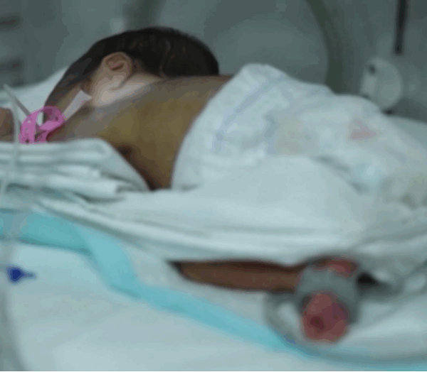 Türkiye’de 100 bebekten 13’ü prematüre doğuyor